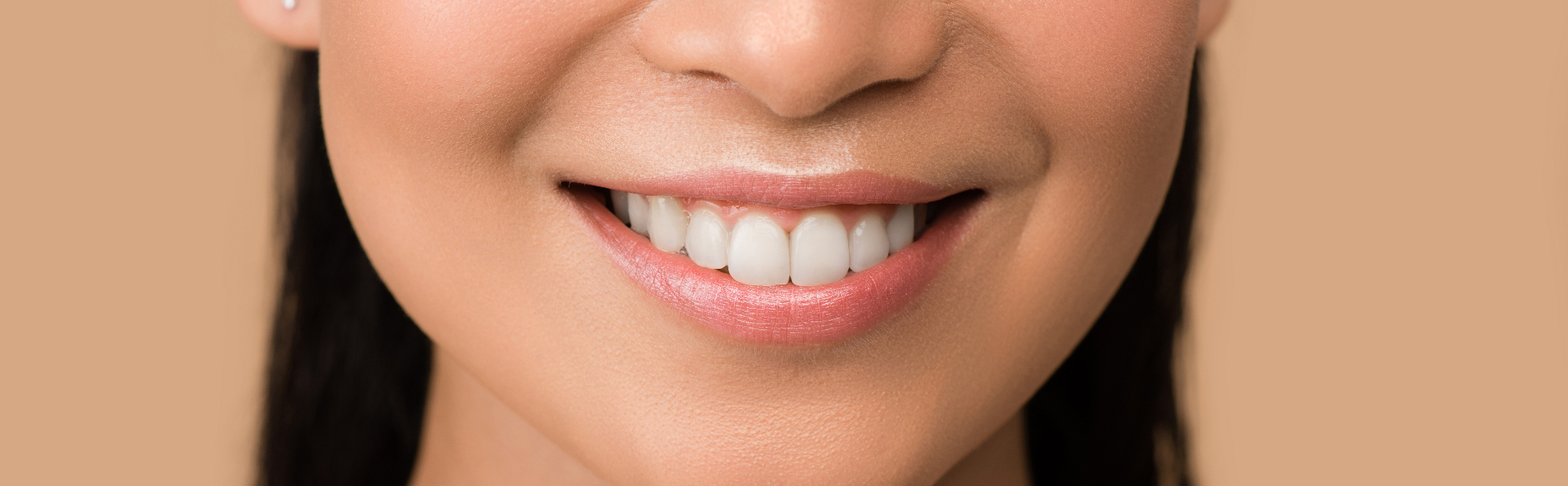 Dentalna ali zobna estetika – kaj vse vam lahko omogoči?